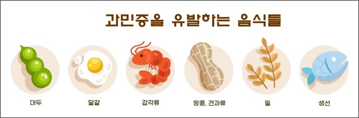 음식물 과민증 검사